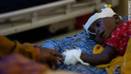 Fátima Abdullah estende a mão para tocar sua filha Abdi, de 8 meses, que foi hospitalizada com desnutrição grave na Somália em julho.